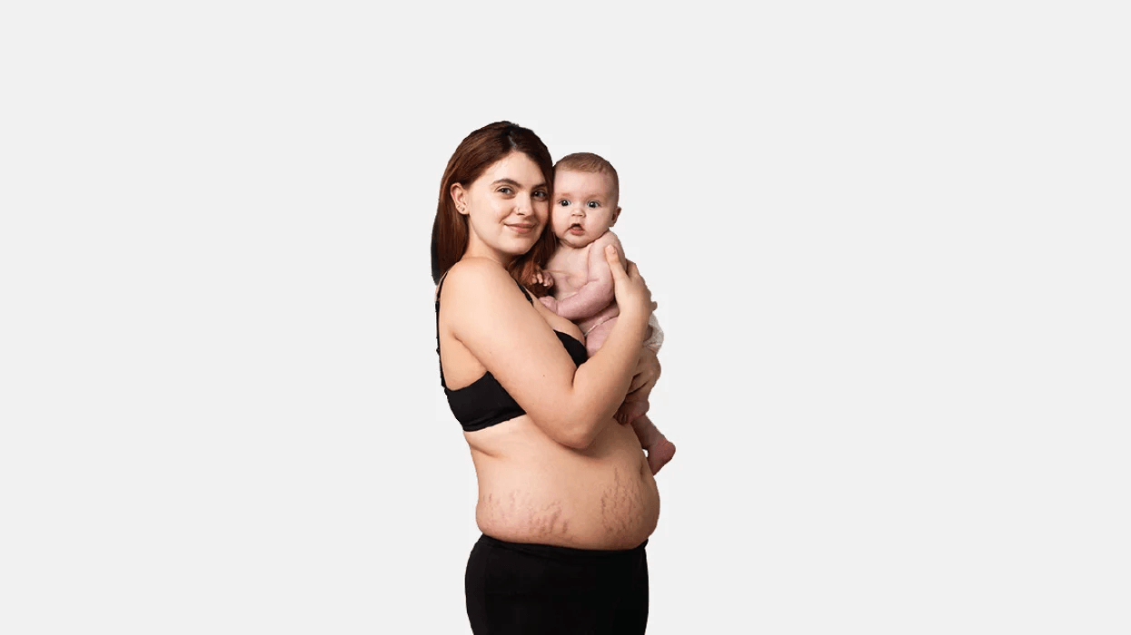 Raw, Real Photos of Women's Postpartum Bodies Celebrate the Beauty