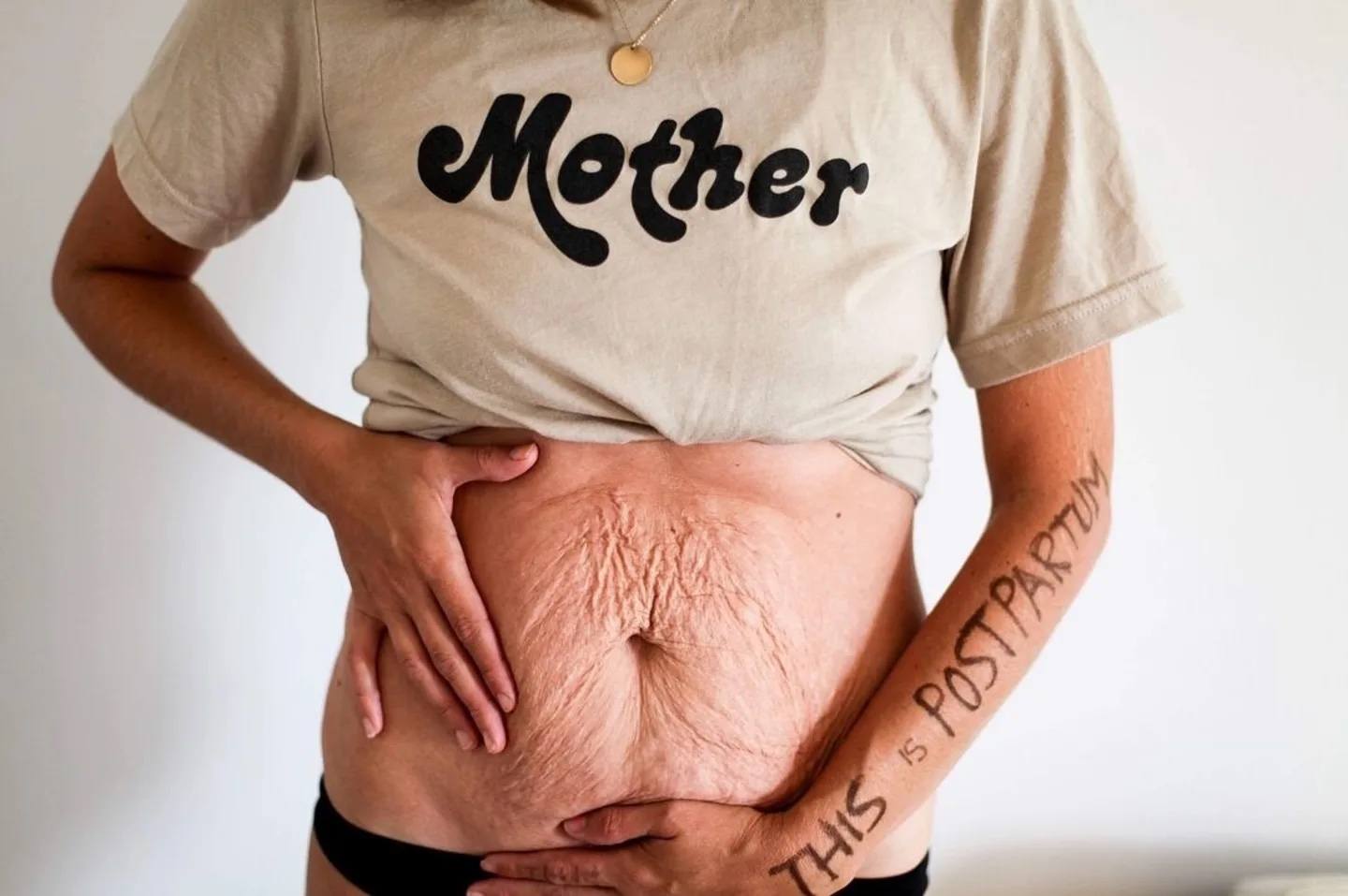 Mom's Post on Postpartum Body