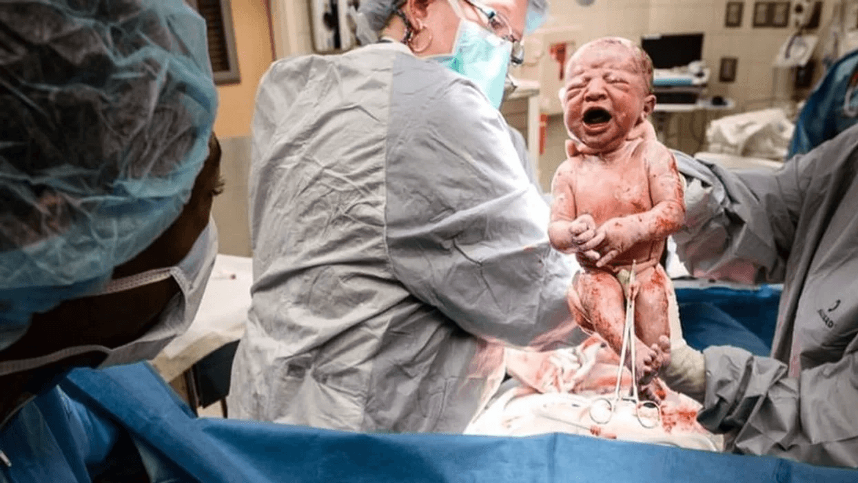 C-Section Awareness  Cesarean Sections and Postpartum Depression