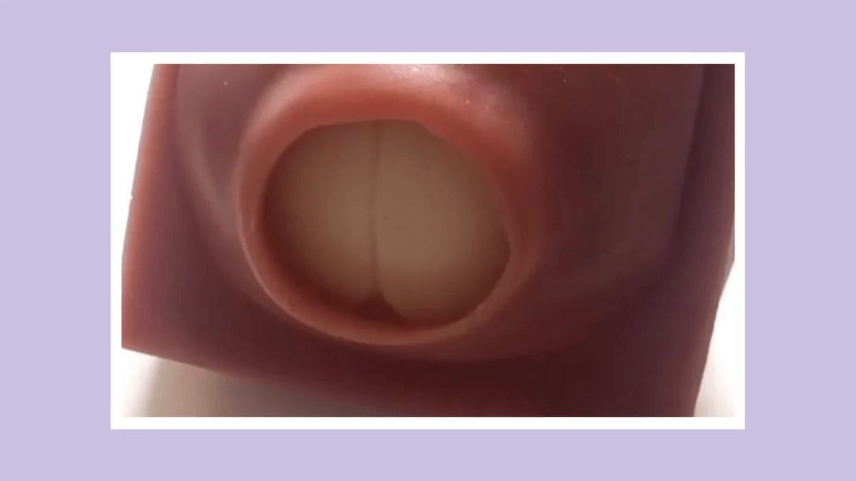 dilated cervix labor