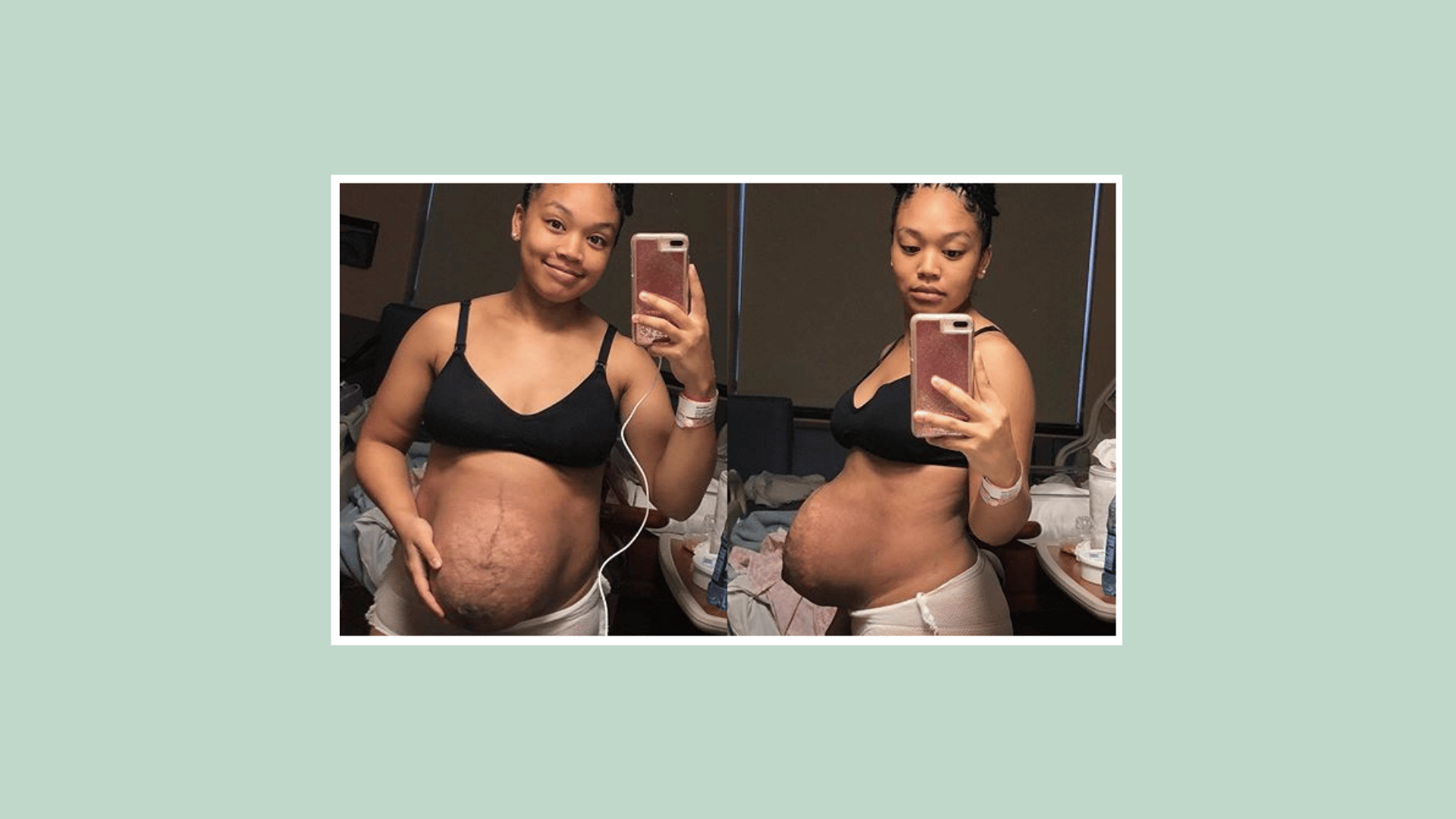 The Blogger Whose Postpartum Body Went Viral