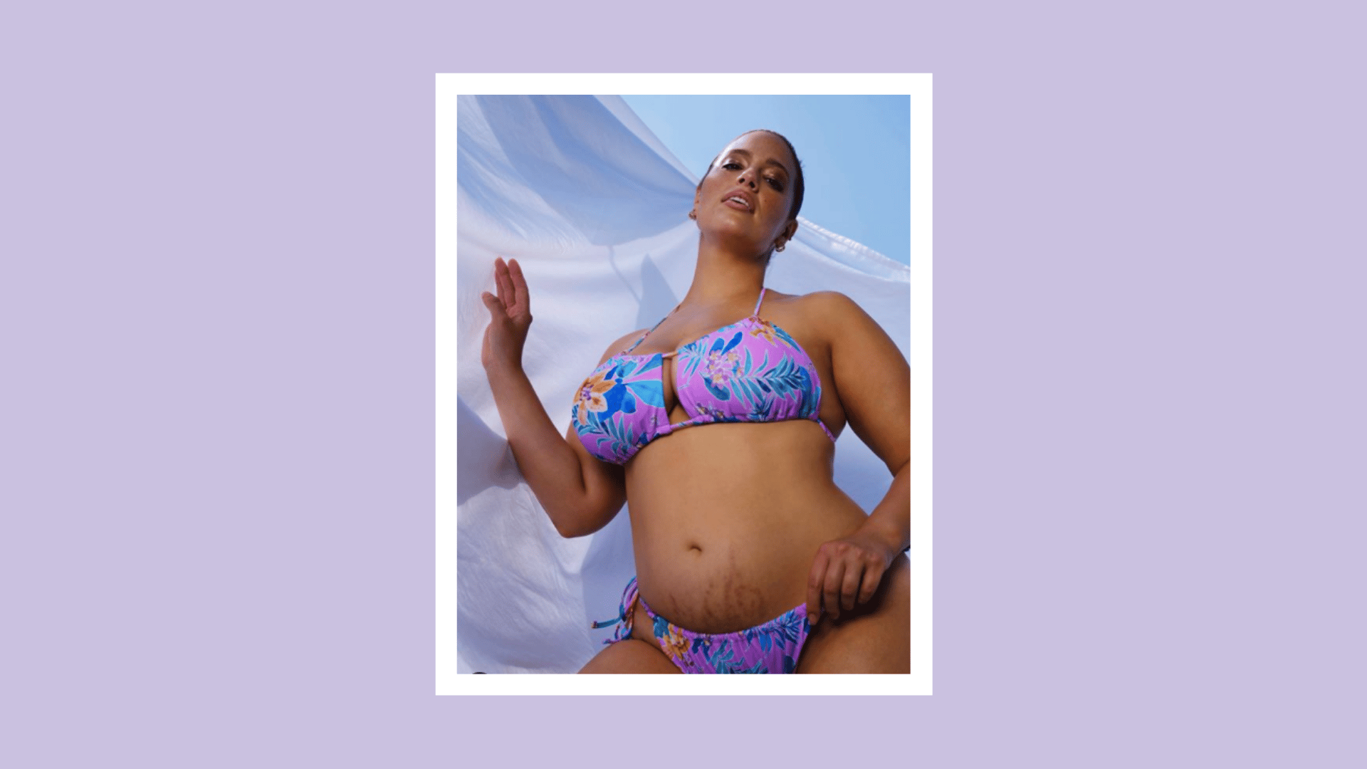 Can you wear a bikini with stretch marks?