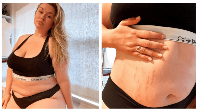 Hunter McGrady postpartum body photos