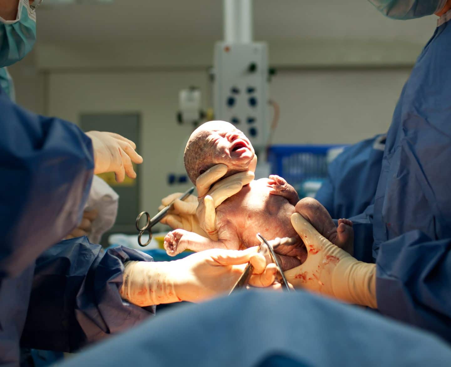 baby being held by doctors after mom's positive c-section experience