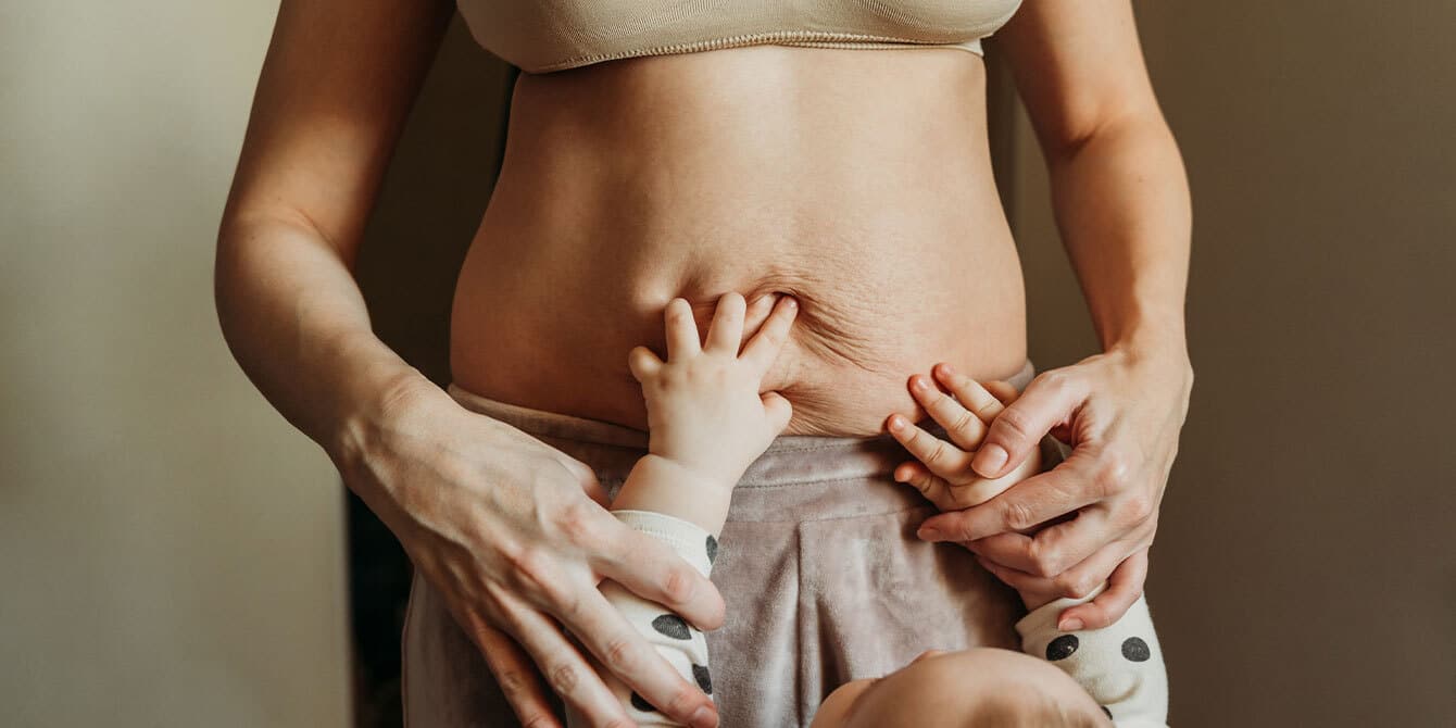 babys hands on moms belly with stretchmarks - essay on the invisibility of motherhood