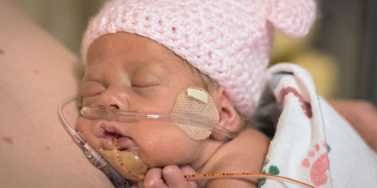 premature infant sleeps on mother's chest while practicing skin-to-skin contact after birth