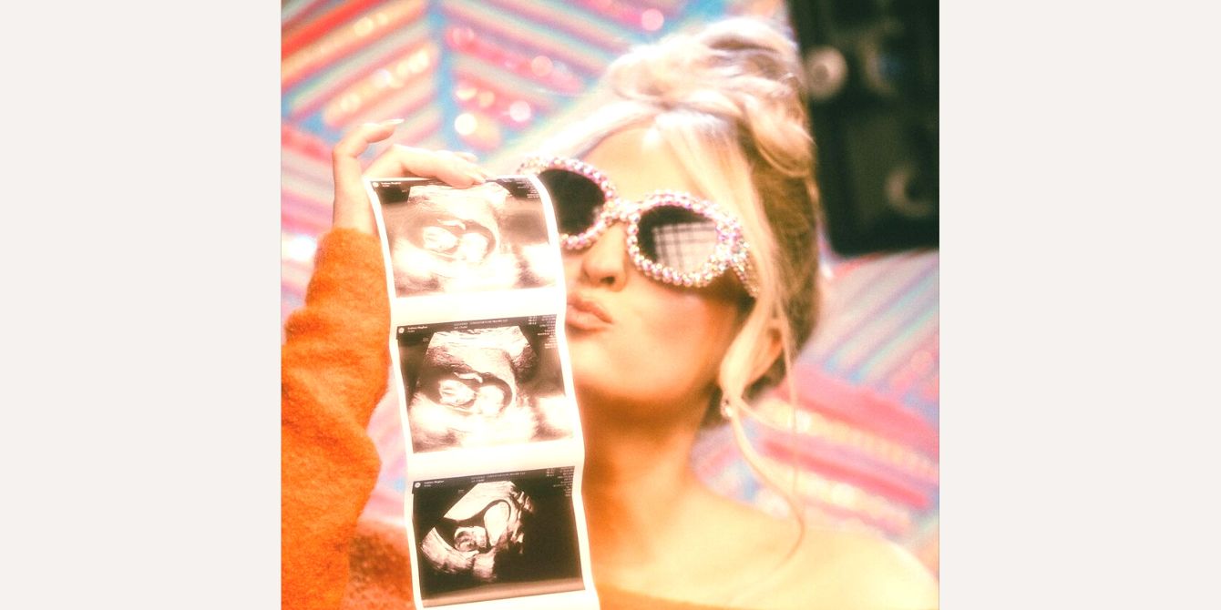 Meghan Trainor holding up a sonogram photo