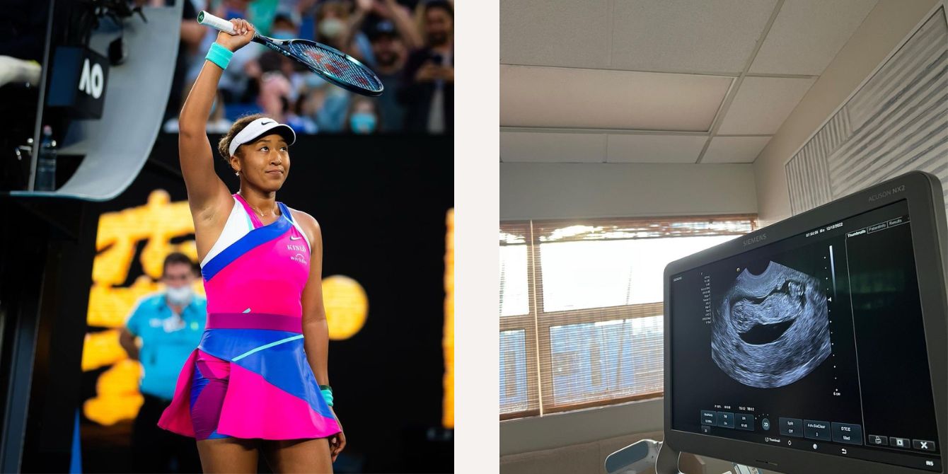 Naomi Osaka: Tennis star reveals pregnancy ahead of Australian Open