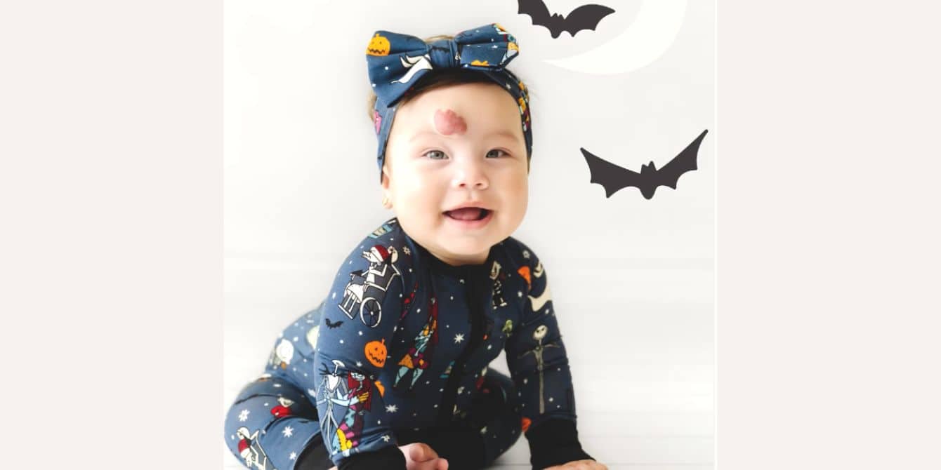 Little Sleepies Features Baby With Hemangioma - Motherly