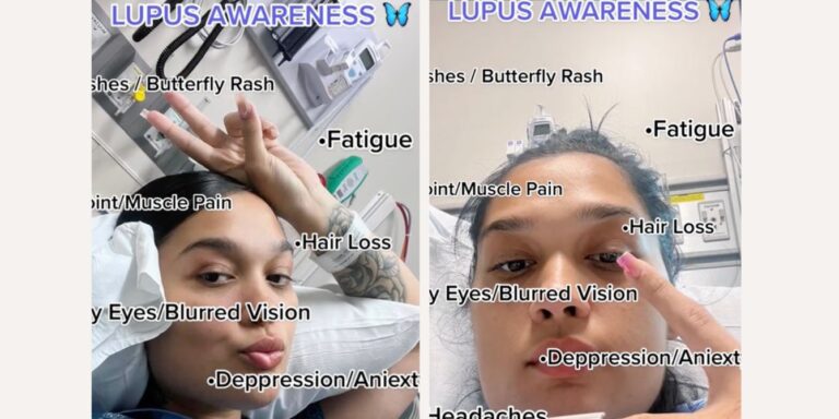 Lupus awareness TikTok