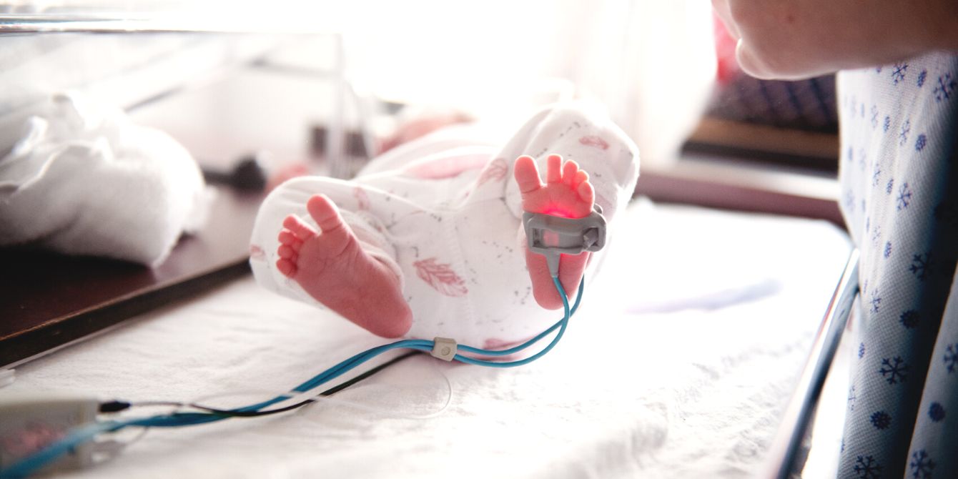 Premature baby in hospital