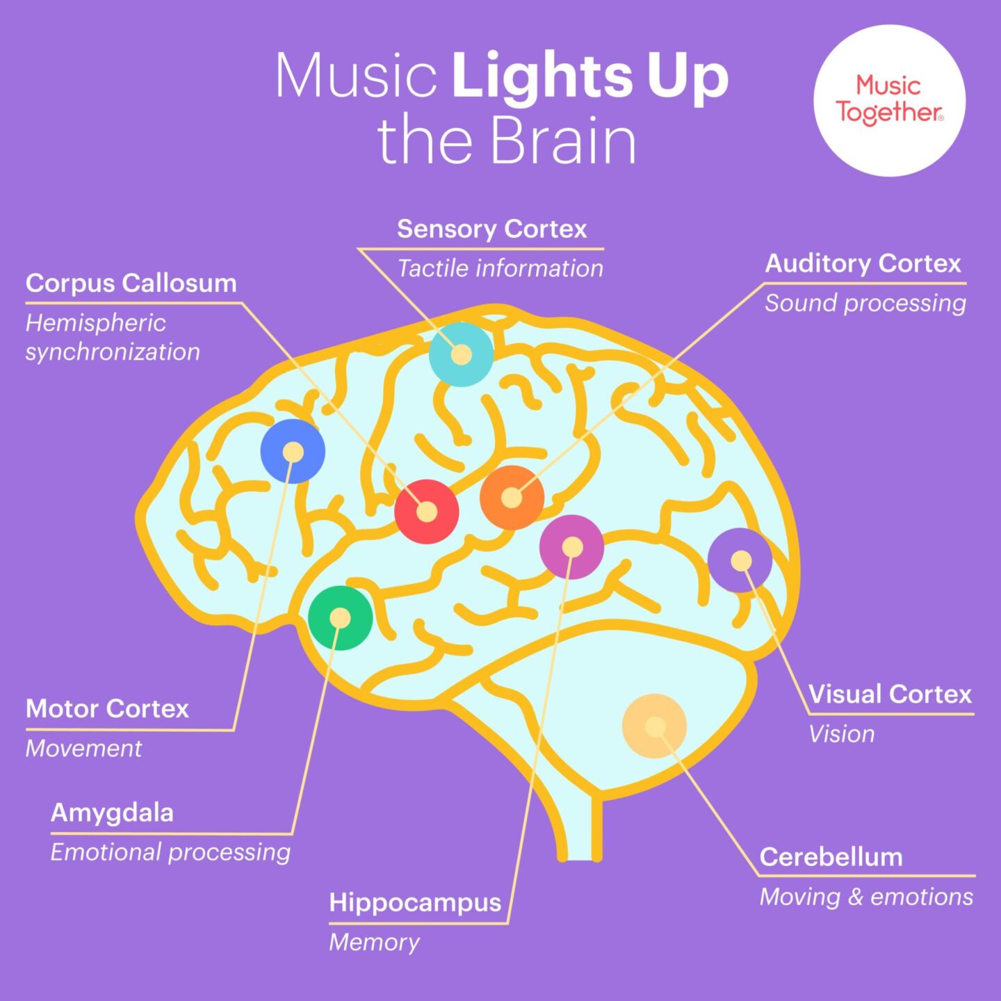 MT Graphic MusicLightsUptheBrain Motherly