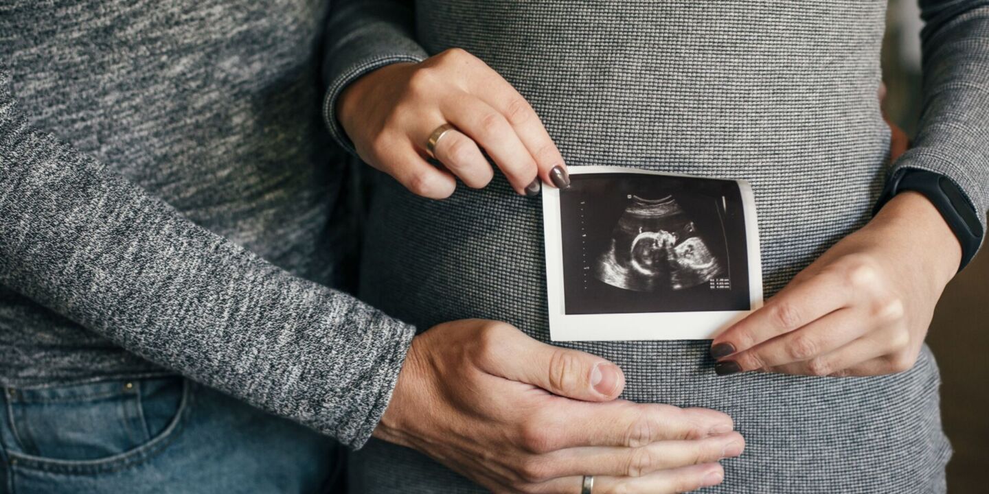 a pregnant woman holding an ultrasound picture on her stomach - preconception health